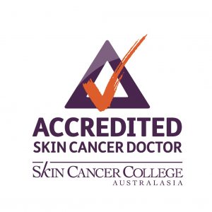 skin check for skin cancer