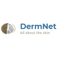 dermnet dermatitis ezcema